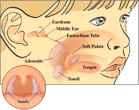 Adenoidi e tonsille