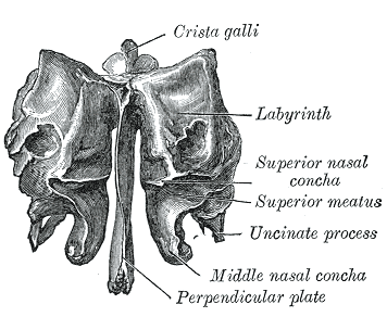 Etmoide